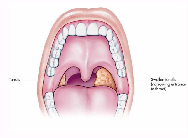 Твердое небо анатомия строение