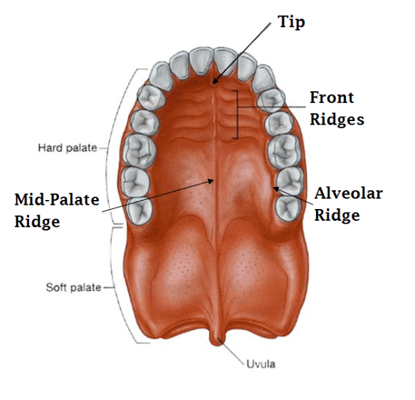 Субмукозная расщелина твердого неба