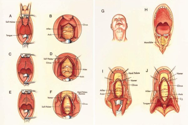 Анатомия зева человека