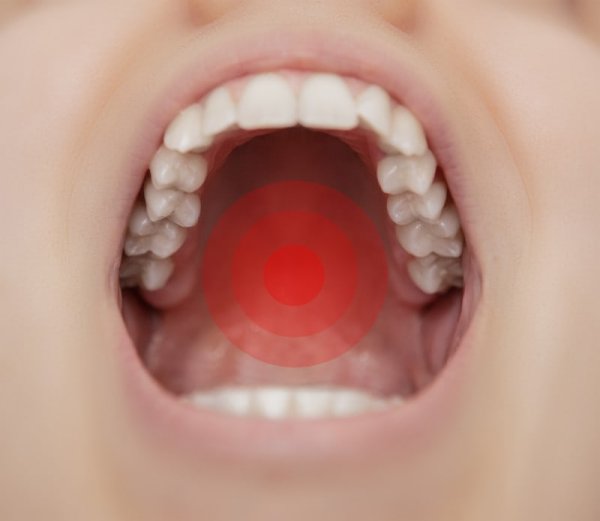 Здоровые зубы открытый рот