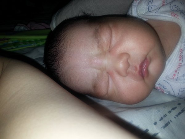 Новообразования в глотке