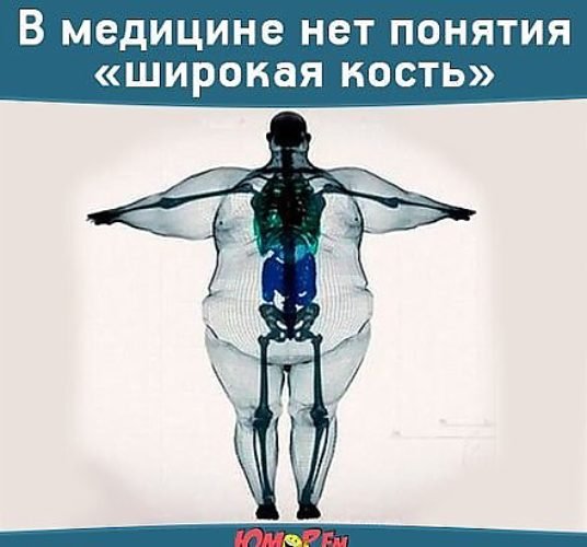 В медицине нет понятия широкая кость