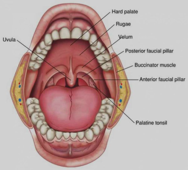 Небное гипертрофия 2 степени