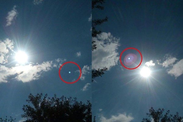 Ангина налет на миндалинах