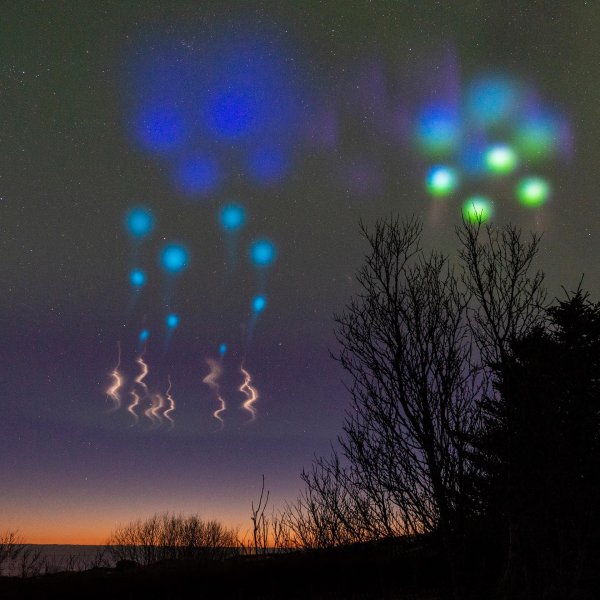 Стрептококковый фарингит