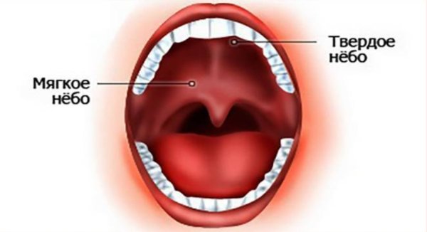 Субатрофический фарингит