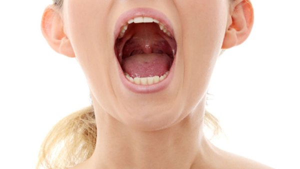 Новообразования в глотке