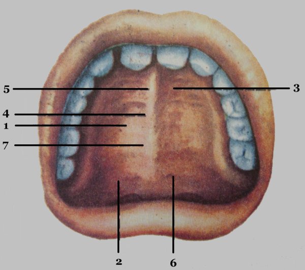 Ангина налет на миндалинах