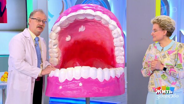 Гранулематозный хейлит Мишера