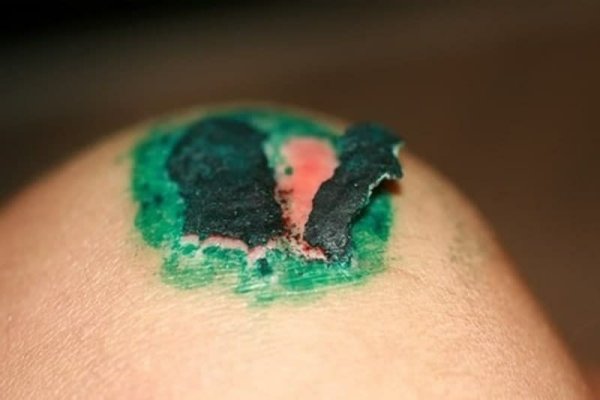 Переходная складка ротовой полости