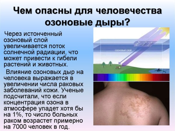 Расщелина твердого неба и альвеолярного отростка