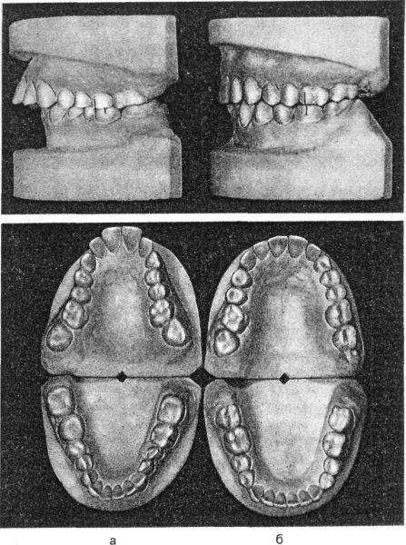 Строение ротовой полости на английском
