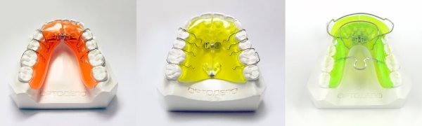 Форма свода твердого неба