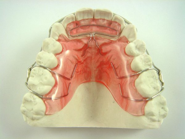Трудная интубация по Маллампати