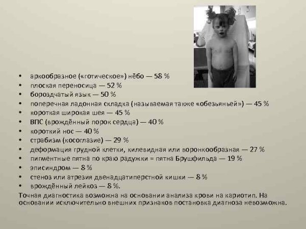 Положение мягкого неба в вокале