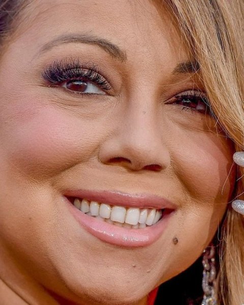 Кристен Стюарт с прыщами