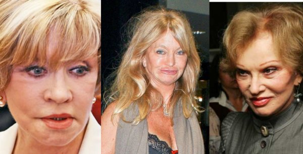 Голди Хоун после пластической операции