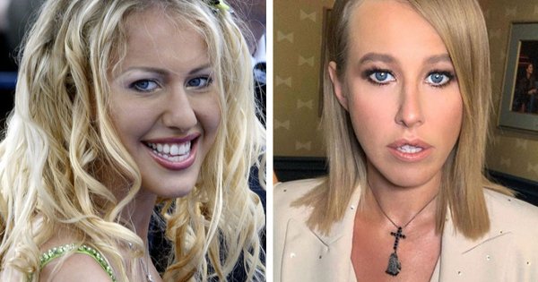 Знаменитости до и после