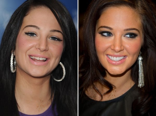 Меган Фокс до и после виниров