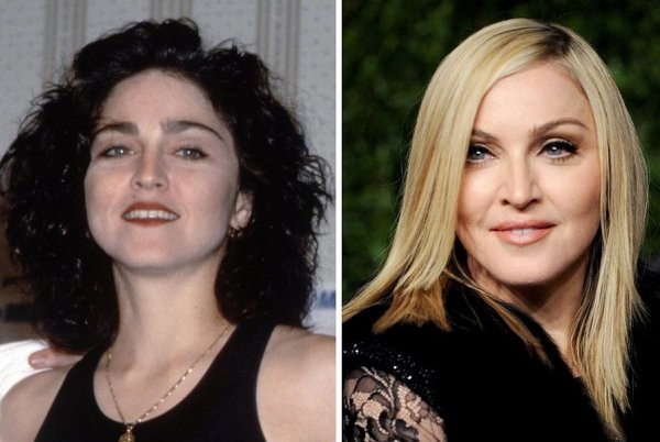 Мадонна до и после пластики