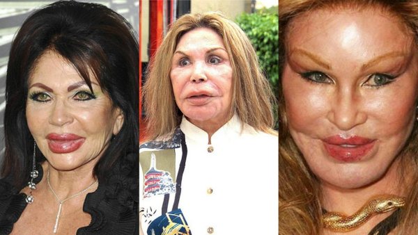 Некдачеая поастика лицпп