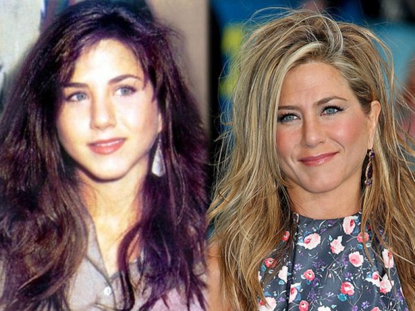 Дженнифер Энистон до пластической операции