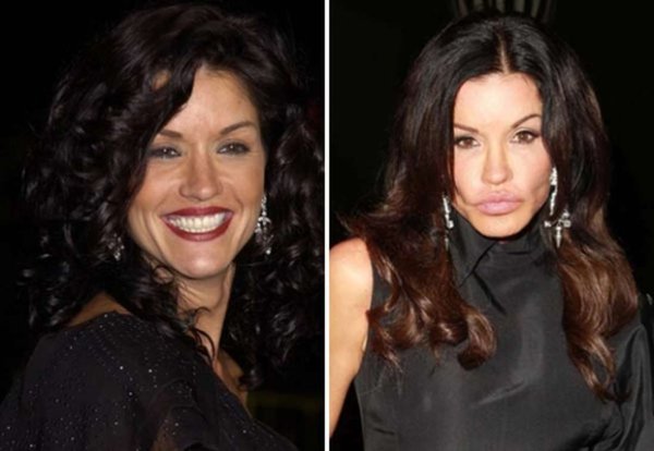 Дженис Дикинсон пластические операции до и после