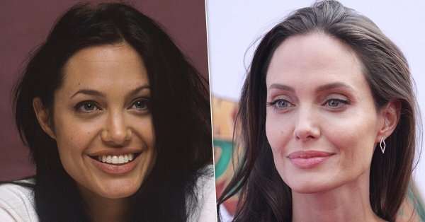 Деми Мур пластика подбородка