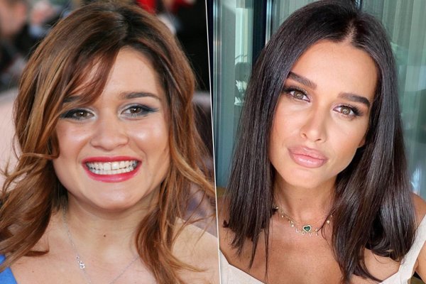 Ксения Бородина до пластики