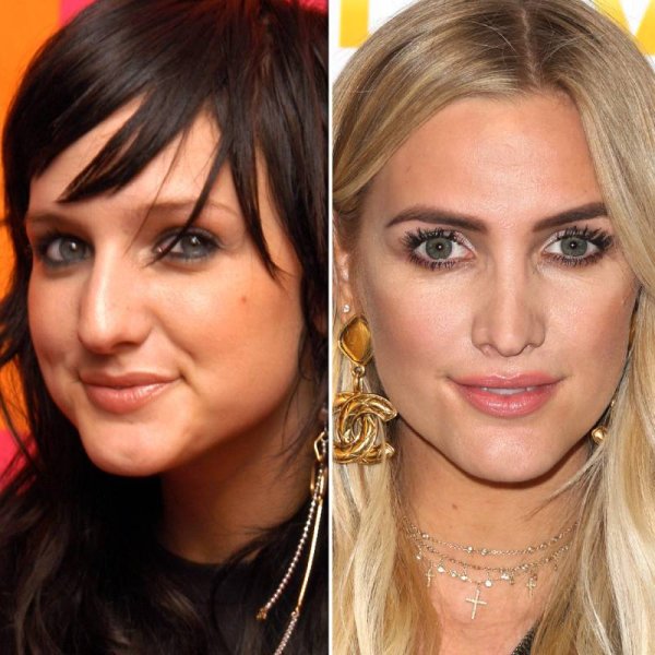 Эшли симпсон до и после ринопластики