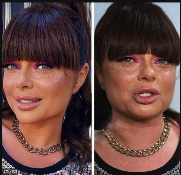 Наташа Королева постарела