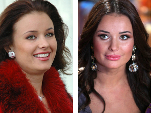 Оксана фёдорова пластическая операция