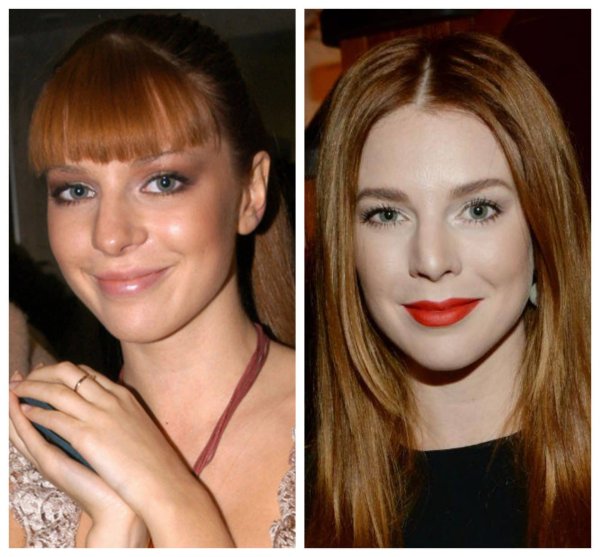 Удачные пластические операции