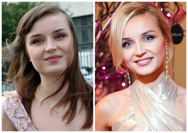 Полина Гагарина до до пластики