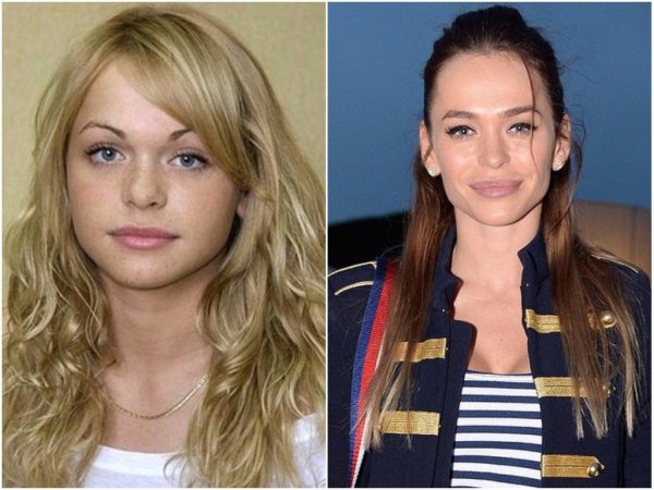 Знаменитости до и после