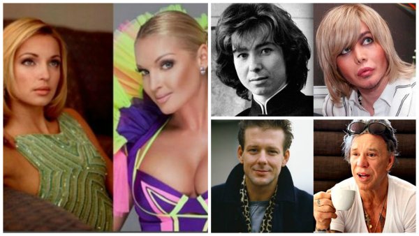 Знаменитости до и после пластики