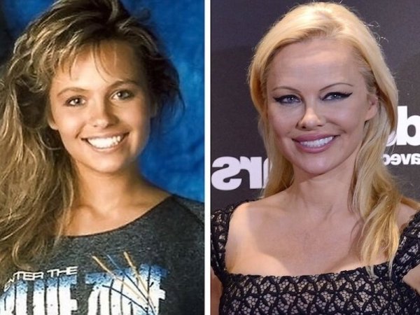 Памелла Андерсон до пластических операций