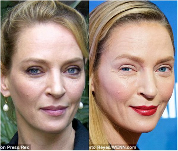 Ума Турман до пластики