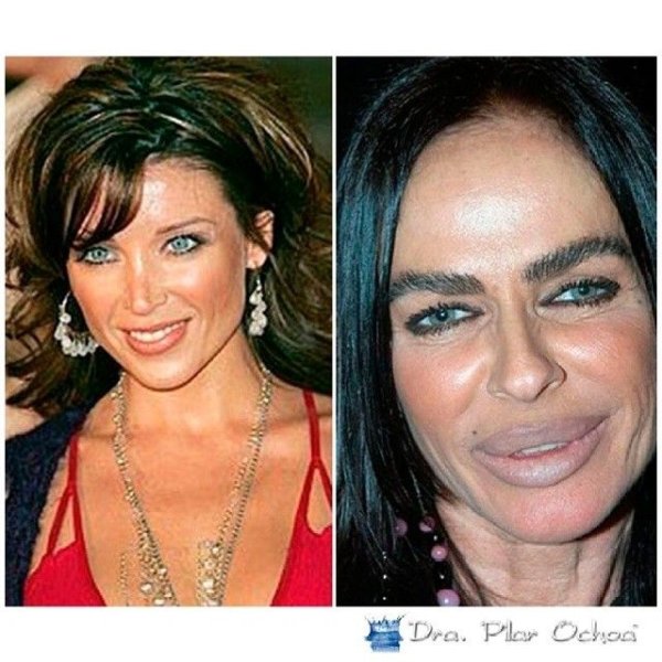 Михаэла романини до операции