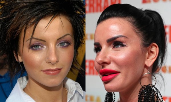 Юлия Волкова губы