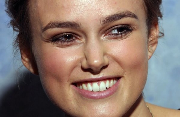 Кира Найтли прыщи