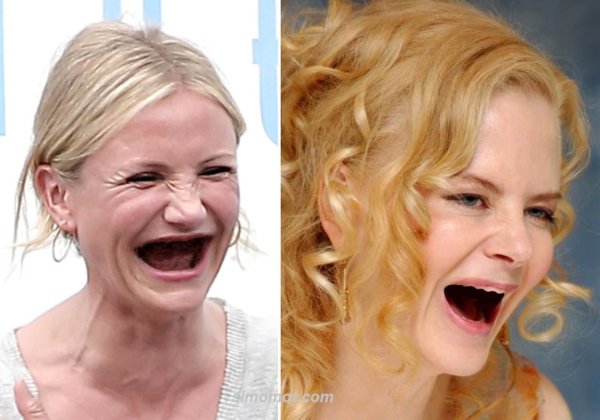 Кэмерон Диаз без зубов