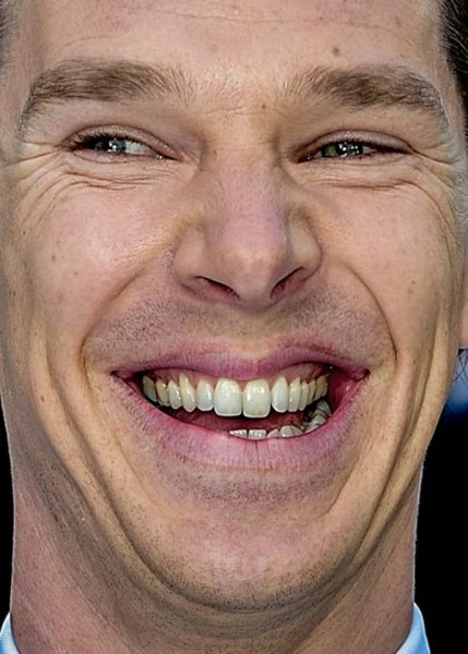 Кривые зубы у Бенедикт Камбербэтч