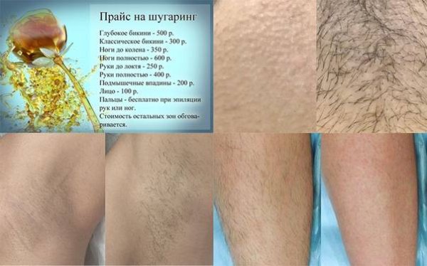 Регулярность шугаринга