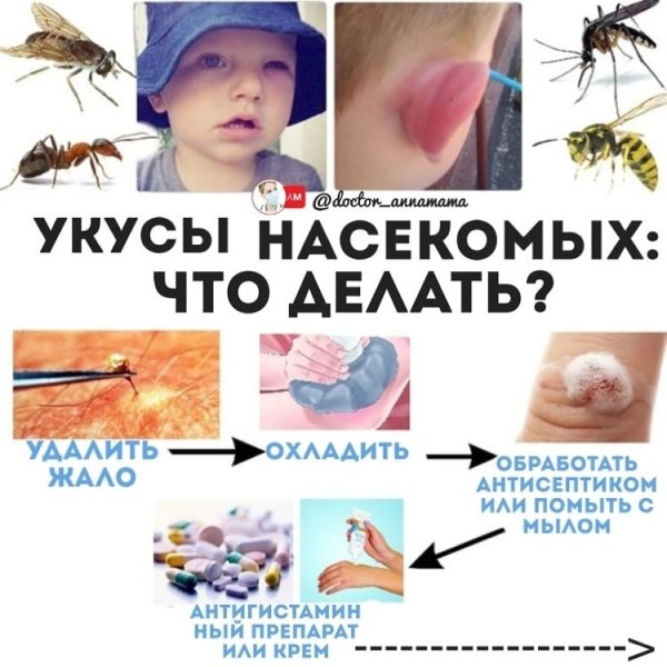 Укусы насекомых первая помощь при укусах