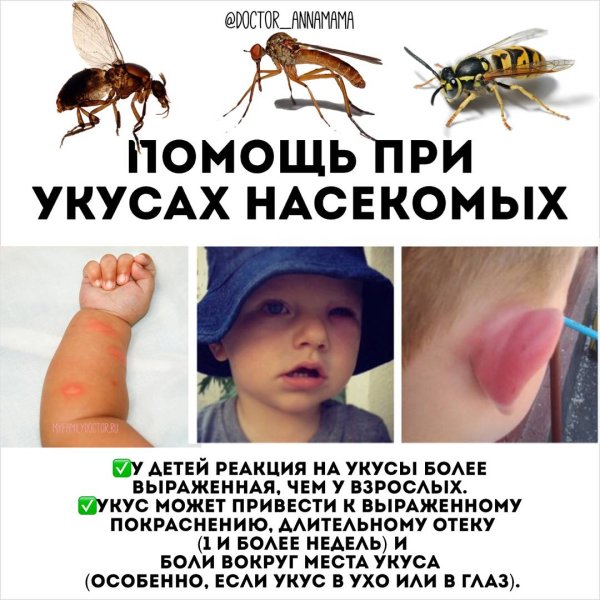Укусы москитов комаров мошек