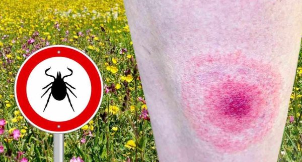 Сбор клещей