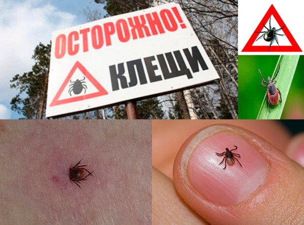 Внимание клещи