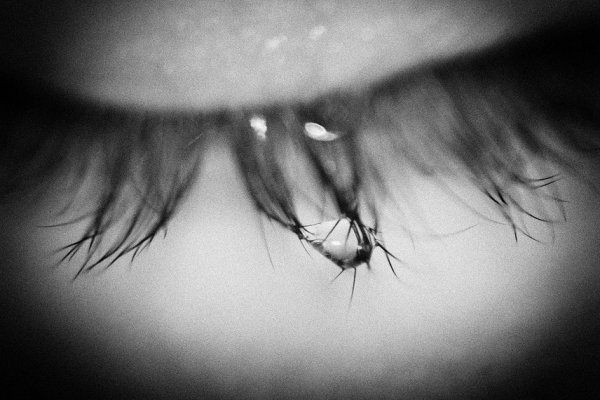 Глаз плачет