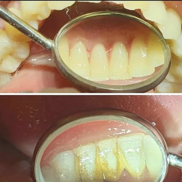 Заболевания по цвету языка